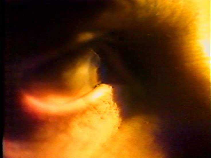 Eye Watching